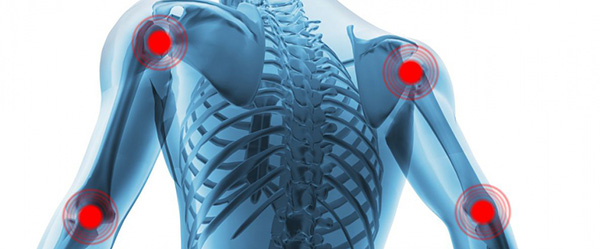 Що являють собою дієтичні БАДи, що впливають на опорно-руховий апарат